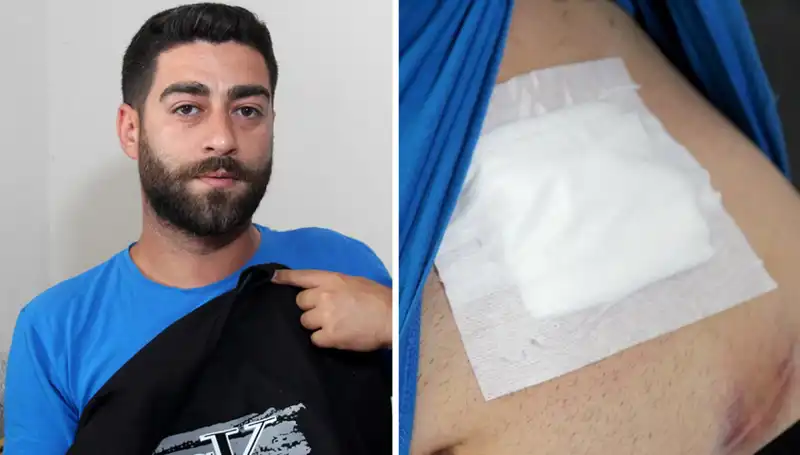 Karnındaki Ağrının Sebebi Şok Etti: Röntgenle Ortaya Çıktı