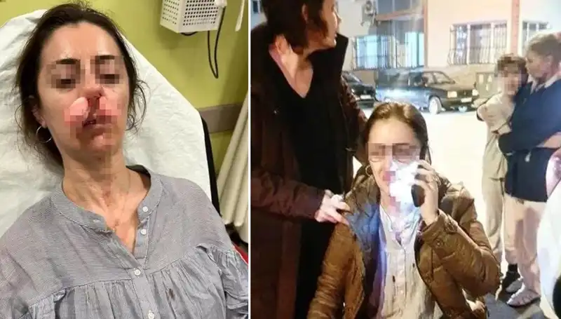 Eşinin Sevgilisi Sandığı Otomobil Kapısıyla Saldırdı: Olayın Perde Arkası