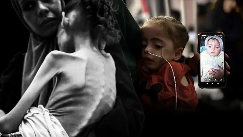 Küçük Meryem’in Açlıkla Mücadelesi: 25 Kilodan 10 Kiloya Düşüşü!