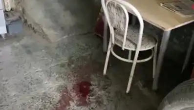 Sandalyeden Düşen Adamın Hayat Mücadelesi: Ağır Yaralandı