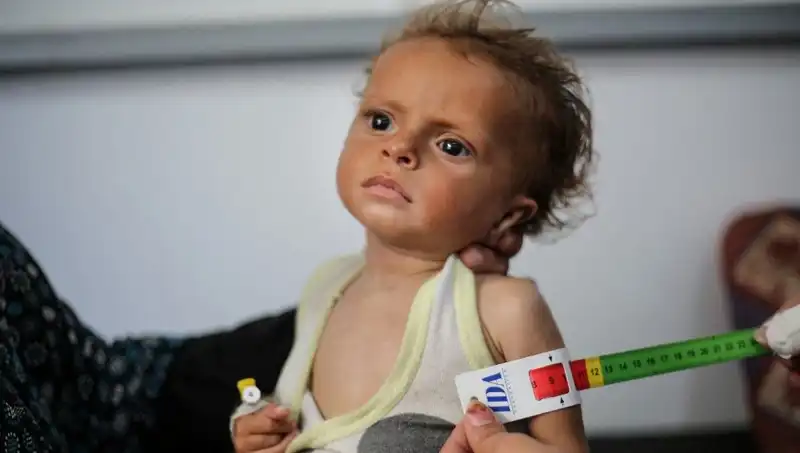 İngiltere, 300 Gazzeli Çocuğa Yeni Bir Başlangıç İmkanı Sunuyor