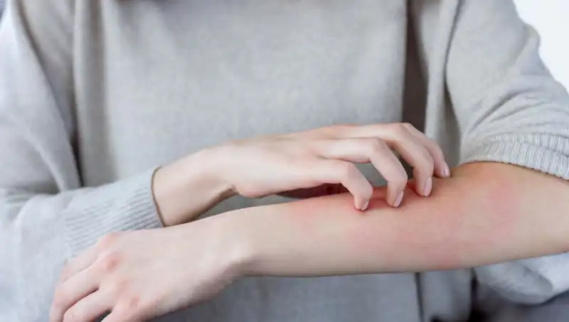 Dermatologdan Şok Açıklama: Cilt Kanseri Teşhisi İçin Gözden Kaçırılan İki Belirti