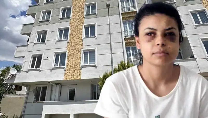 Düğünde Maganda Dehşeti: Gelinin Gözünü Vuran Silah Saçmaları
